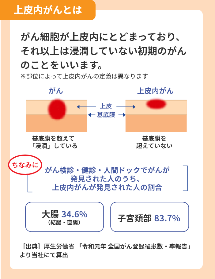 上皮内がんとは